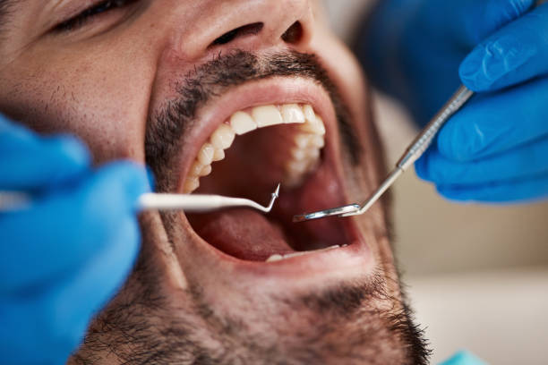 Emergency Dental Services in Moraine, OH
